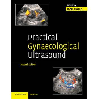 Practical Gynaecological Ultrasound | Jane Bates