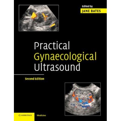 Practical Gynaecological Ultrasound | Jane Bates