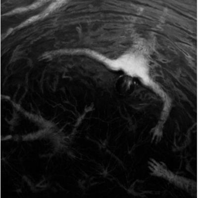 The Approaching Roar - Altarage LP