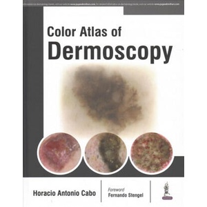 Color Atlas of Dermoscopy | Horacio Cabo (ISBN: 9789386056306)