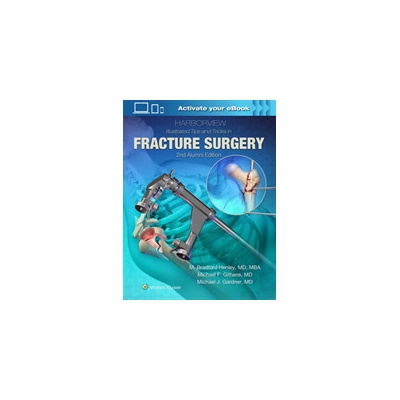 Harborview Illustrated Tips and Tricks in Fracture Surgery Henley M. Pevná vazba