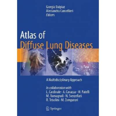 Atlas of Diffuse Lung Diseases