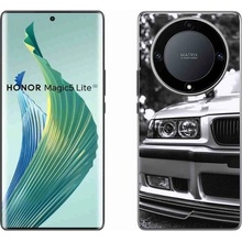 mmCase Gelové Honor Magic 5 Lite 5G - auto 4