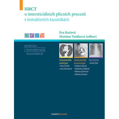 HRCT vyšetření u intersticiálních plicních procesů