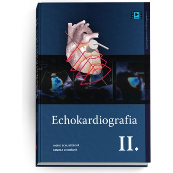 Echokardiografia II.