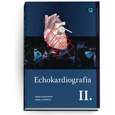 Echokardiografia II.