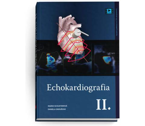Echokardiografia II.