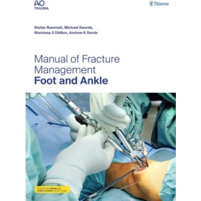 Manual of Fracture Management - Foot and Ankle | Stefan Rammelt, Michael P. Swords, Mandeep S. Dhillon, Andrew K. Sands