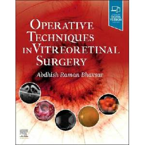 Operative Techniques in Vitreoretinal Surgery | Abdhish Bhavsar (ISBN: 9780323709200)