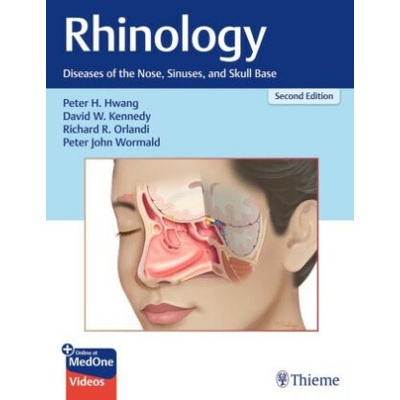 Rhinology : Diseases of the Nose, Sinuses, and Skull Base - Peter H. Hwang