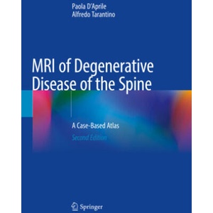 MRI of Degenerative Disease of the Spine (2022)