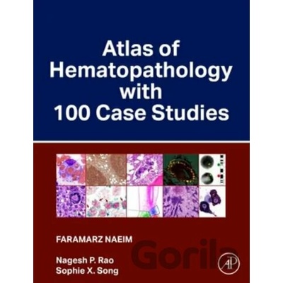 Atlas of Hematopathology with 100 Case Studies - Faramarz Naeim