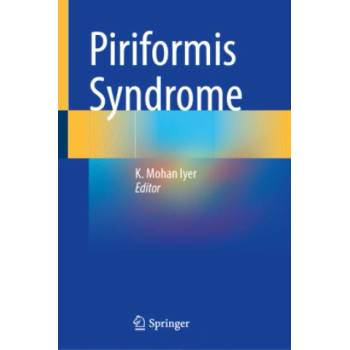 Piriformis Syndrome | K. Mohan Iyer