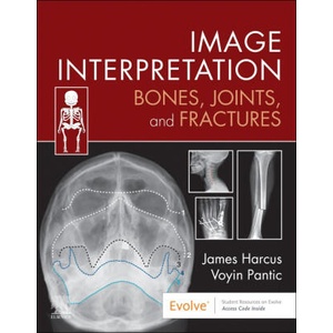 Image Interpretation: Bones, Joints, and Fractures | James Harcus, Voyin Pantic (ISBN: 9780323870801)