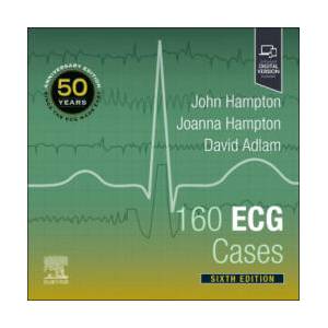 160 ECG Cases | John Hampton, Joanna Hampton, David Adlam (ISBN: 9780323937658)