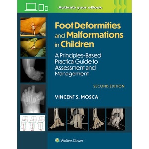 Foot Deformities and Malformations in Children | Vincent Mosca (ISBN: 9781975213374)