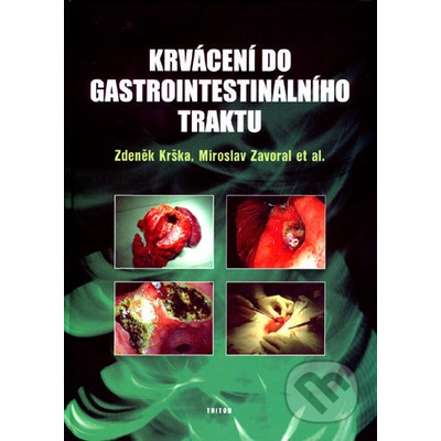 Krvácení do gastrointestinálního traktu - Zdeněk Krška, Miroslav Zavoral