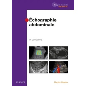 Echographie abdominale | Olivier Lucidarme (ISBN: 9782294734137)