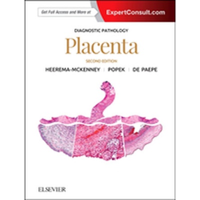 Diagnostic Pathology: Placenta Heerema-McKenney Amy