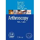 Arthroscopy
