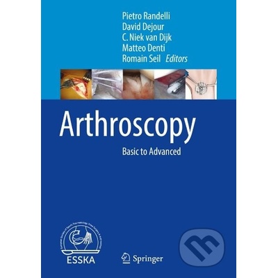 Arthroscopy