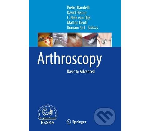 Arthroscopy