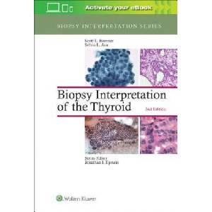 Biopsy Interpretation of the Thyroid | Scott L. Boerner, Sylvia L. Asa (2016)