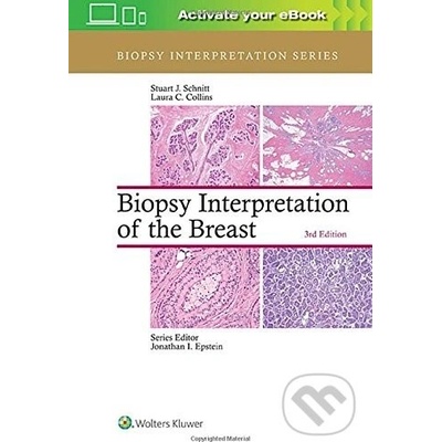 Biopsy Interpretation of the Breast Schnitt Stuart J.