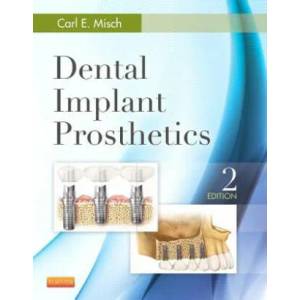Dental Implant Prosthetics | Carl Misch (ISBN: 9780323078450)