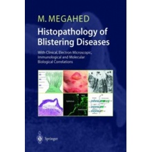 Histopathology of Blistering Diseases