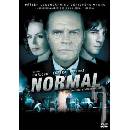 Normal DVD
