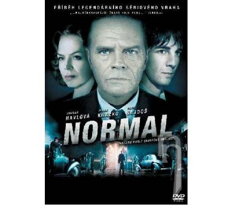 Normal DVD