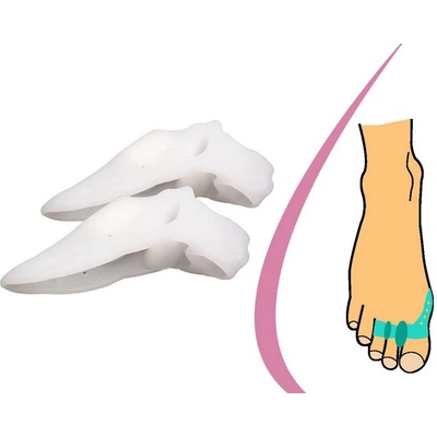 Hallux Valgus Korektor s návlekom na prsty
