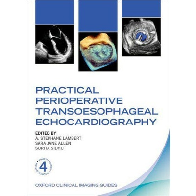 Practical Perioperative Transoesophageal Echocardiography