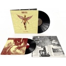 IN UTERO