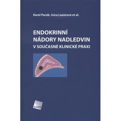 Endokrinní nádory nadledvin v současné klinické praxi - Karel Pacák, Ivica Lazúrová