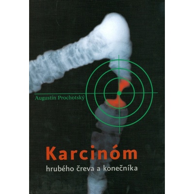 Karcinóm hrubého čreva a konečníka - Augustín Prochotský