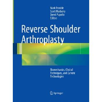 Reverse Shoulder Arthroplasty | Mark Frankle, Scott Marberry, Derek Pupello