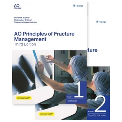 AO Principles of Fracture Management