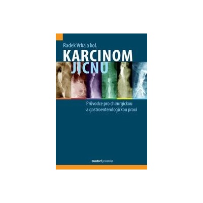 Karcinom jícnu - Průvodce pro chirurgickou a gastroenterologickou praxi