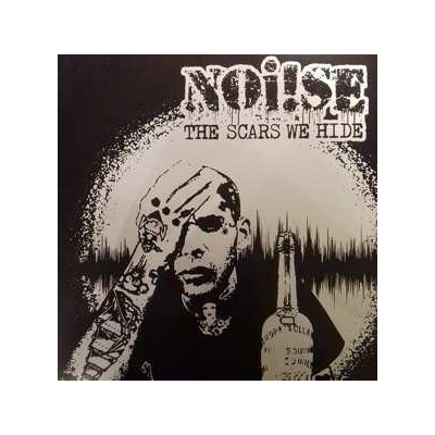 Noi!se - The Scars We Hide LP