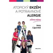 Atopický ekzém a potravinové alergie očima mámy - Jana Ligurská