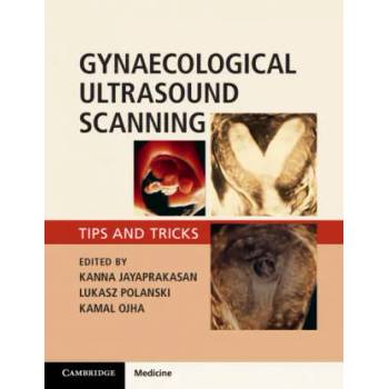 Image 1 of Gynaecological Ultrasound Scanning | Kanna Jayaprakasan, Lukasz T. Polanski, Kamal Ojha