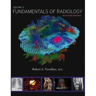 Squires Fundamentals of Radiology - Robert A. Novelline