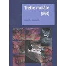 Tretie moláre M3