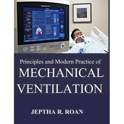 PRINCIPLES AND MODERN PRACTICE OF MECHANICAL VENTILATION