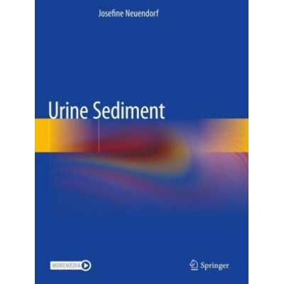 Urine Sediment