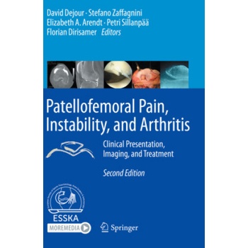 Patellofemoral Pain, Instability, and Arthritis: Clinical Presentation, Imaging, and Treatment | David Dejour, Stefano Zaffagnini, Elizabeth A. Arendt
