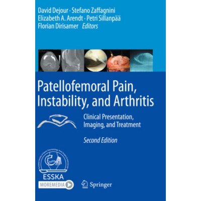 Patellofemoral Pain, Instability, and Arthritis: Clinical Presentation, Imaging, and Treatment | David Dejour, Stefano Zaffagnini, Elizabeth A. Arendt