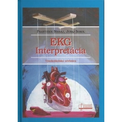 Nehaj František, Sokol Juraj - EKG interpretácia
